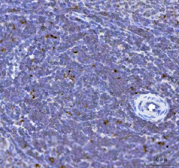 Anti-TFEB Antibody