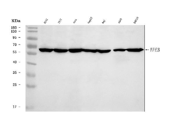 Anti-TFEB Antibody