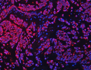 Anti-TFEB Antibody