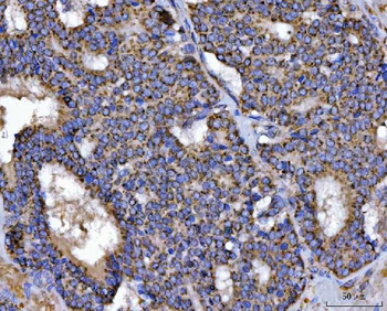 Anti-TFEB Antibody