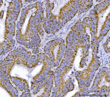 Anti-TFEB Antibody