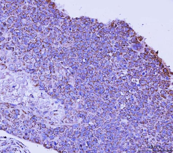 Anti-TFEB Antibody