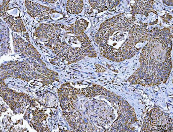 Anti-TFEB Antibody