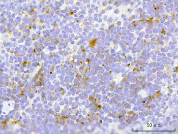 Anti-TFEB Antibody