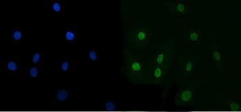 Anti-TRBP/TARBP2 Antibody