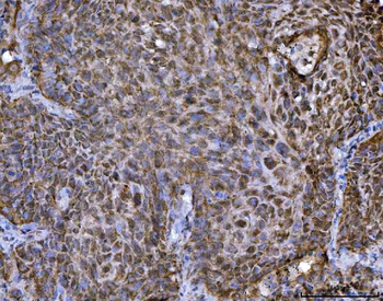 Anti-TRBP/TARBP2 Antibody