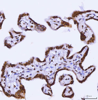 Anti-TRBP/TARBP2 Antibody