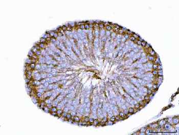 Anti-TRBP/TARBP2 Antibody