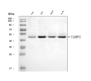 Anti-TRBP/TARBP2 Antibody