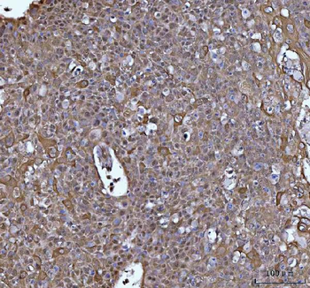 Anti-SOCS1 Antibody