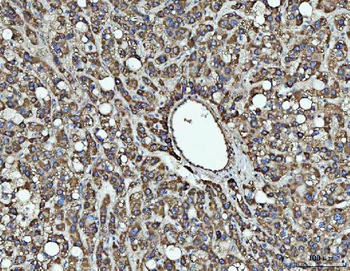 Anti-SOCS1 Antibody