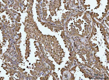 Anti-SOCS1 Antibody