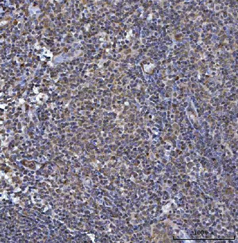 Anti-SOCS1 Antibody