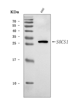 Anti-SOCS1 Antibody
