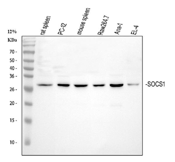 Anti-SOCS1 Antibody