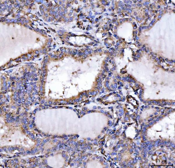 Anti-SLU7 Antibody