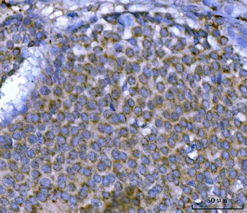 Anti-MSF/SEPTIN9 Antibody