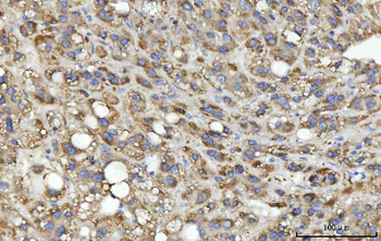 Anti-MSF/SEPTIN9 Antibody