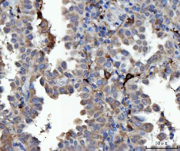 Anti-MSF/SEPTIN9 Antibody
