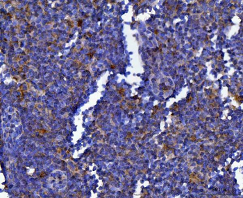 Anti-MSF/SEPTIN9 Antibody