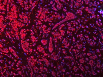 MSF/SEPTIN9 Antibody