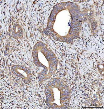 Anti-SEPT7/SEPTIN7 Antibody