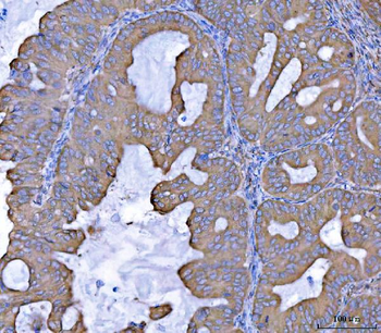 Anti-SEPT7/SEPTIN7 Antibody
