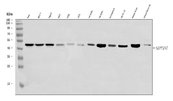 Anti-SEPT7/SEPTIN7 Antibody