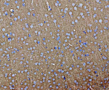 Anti-Septin 3/SEPTIN3 Antibody