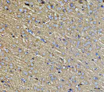 Anti-Septin 3/SEPTIN3 Antibody