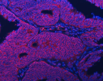 Anti-Septin 2/SEPTIN2 Antibody