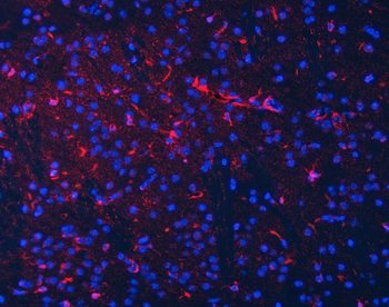 Anti-Septin 2/SEPTIN2 Antibody