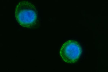 Anti-Septin 2/SEPTIN2 Antibody