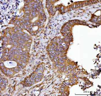Anti-Septin 2/SEPTIN2 Antibody