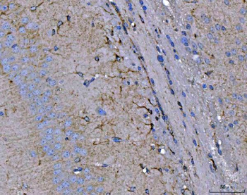 Anti-Septin 2/SEPTIN2 Antibody