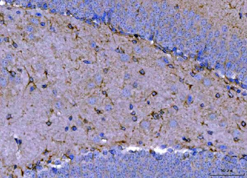 Anti-Septin 2/SEPTIN2 Antibody