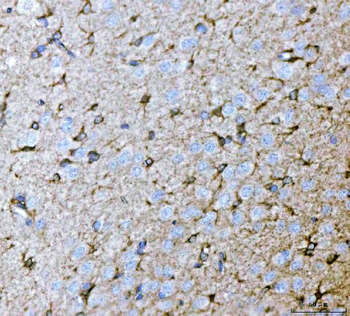 Anti-Septin 2/SEPTIN2 Antibody