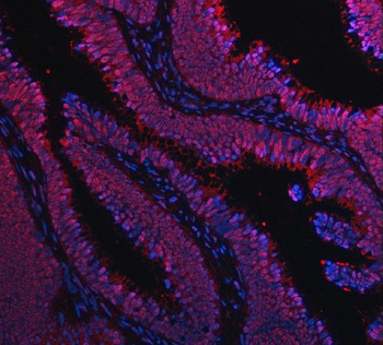 Anti-TIP49A/RUVBL1 Antibody