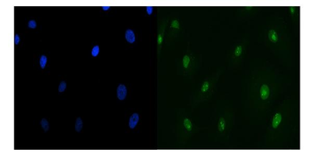 Anti-TIP49A/RUVBL1 Antibody