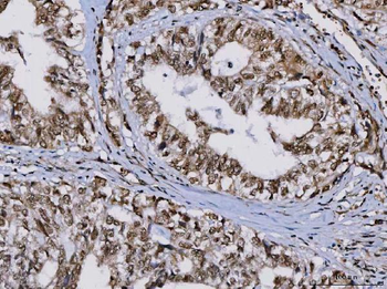 Anti-TIP49A/RUVBL1 Antibody