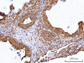 Anti-TIP49A/RUVBL1 Antibody