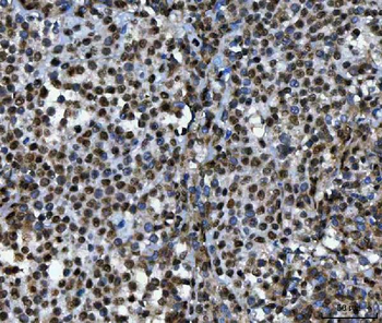 Anti-TIP49A/RUVBL1 Antibody