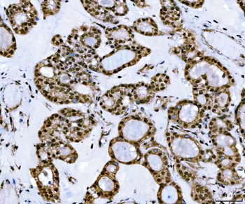 Anti-TIP49A/RUVBL1 Antibody