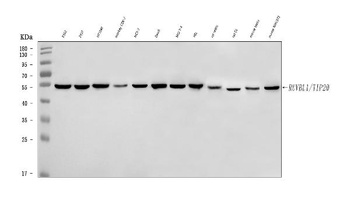TIP49A/RUVBL1 Antibody
