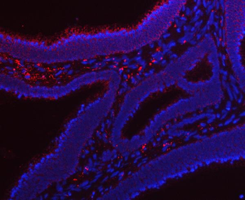 Anti-RRS1 Antibody