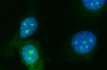 Anti-RRS1 Antibody