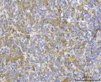 Anti-RRS1 Antibody