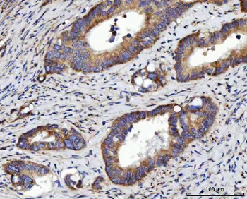 Anti-RRS1 Antibody