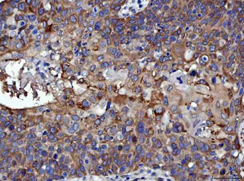 Anti-RRS1 Antibody