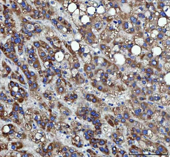 Anti-RRS1 Antibody